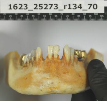 The teeth of the woman found in the Ice Valley are well preserved.