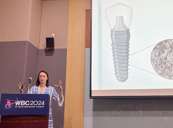 Agnes Rogala&#39;s animated talk on probiotic biofilms on dental implants was very engaging and resulted in many good questions from the audience.